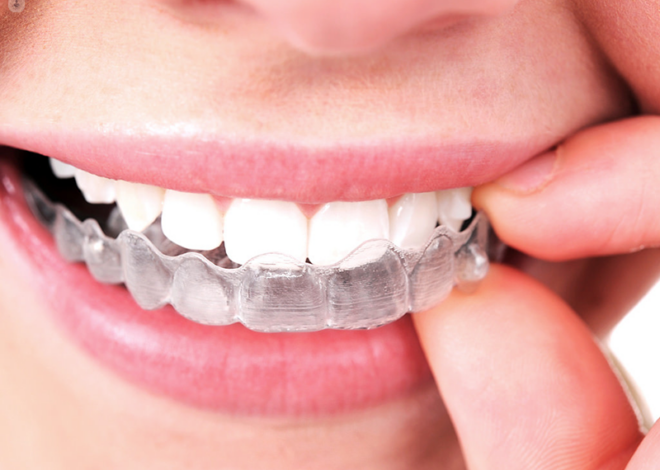 How Invisalign Adapts to Complex Bite Corrections and Dental Challenges