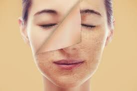 Strengthening Daily Blemish Management with Zit Buster Focused Skincare Practices